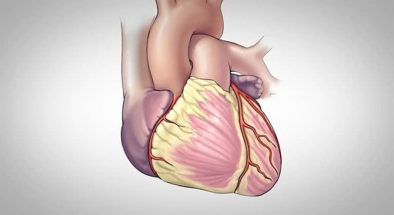 Coronary Artery Bypass Surgery in hyderabad