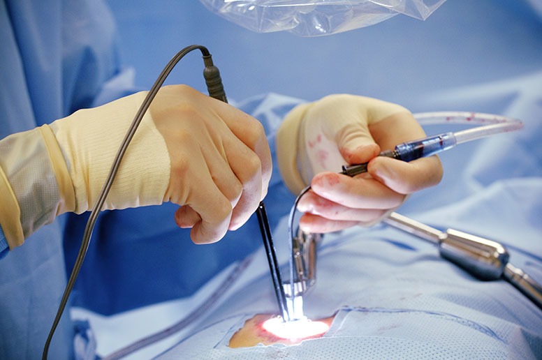 Cardiac surgery in hyderabad